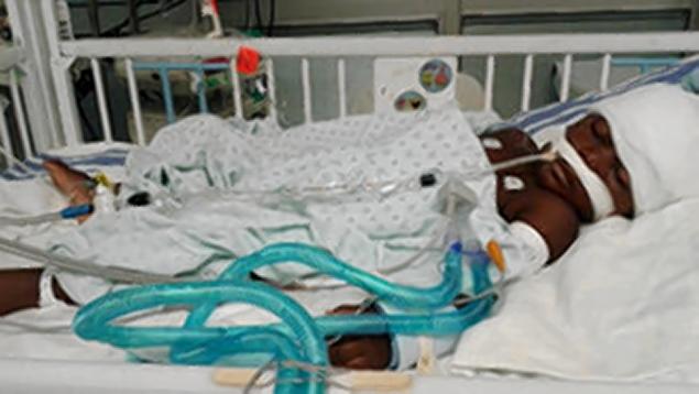 shabba shot in head survives