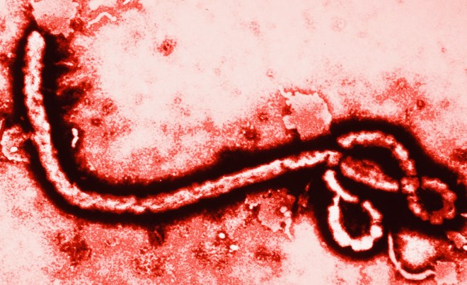 Ebola Virus