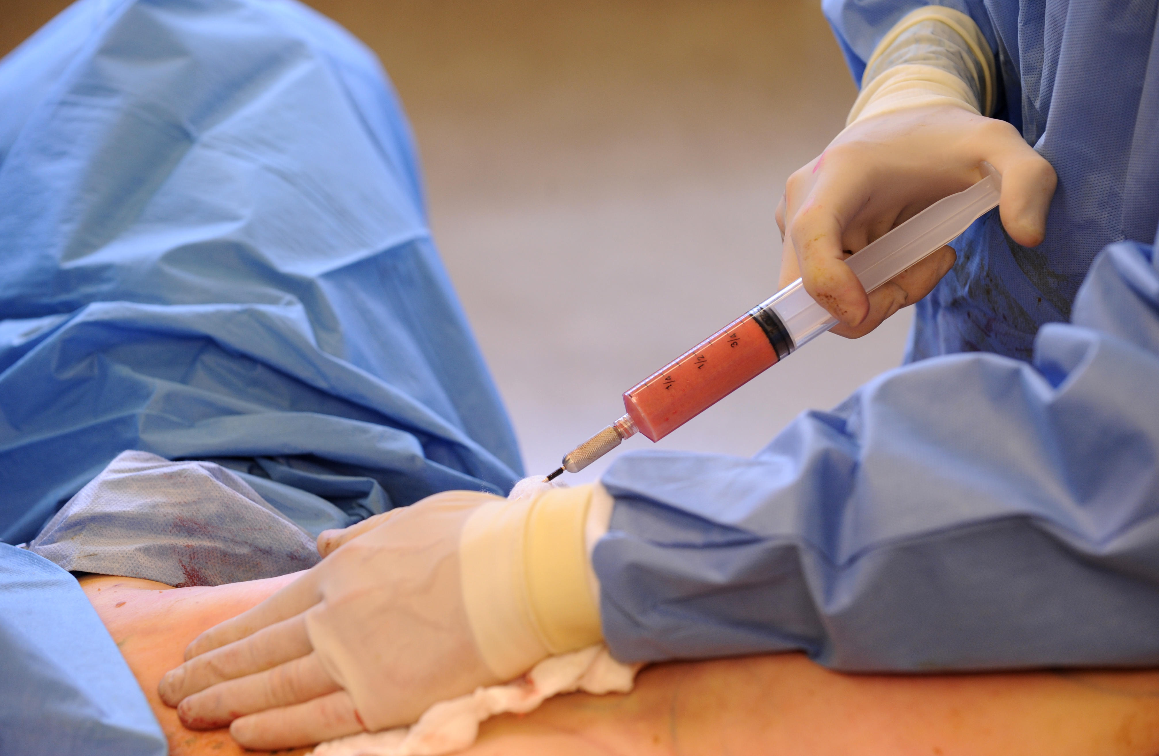 BBL, social media, cosmetic procedure, lip fillers, Botox, Face Med Store 
