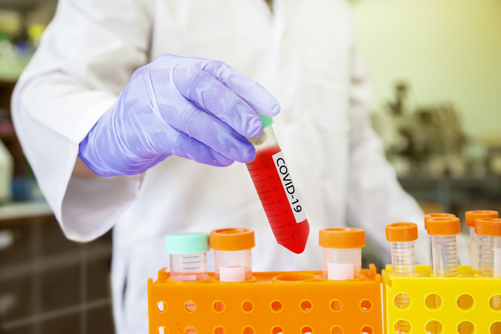 Microbiologist with a tube of biological sample contaminated by Coronavirus with label Covid-19 in the laboratory.