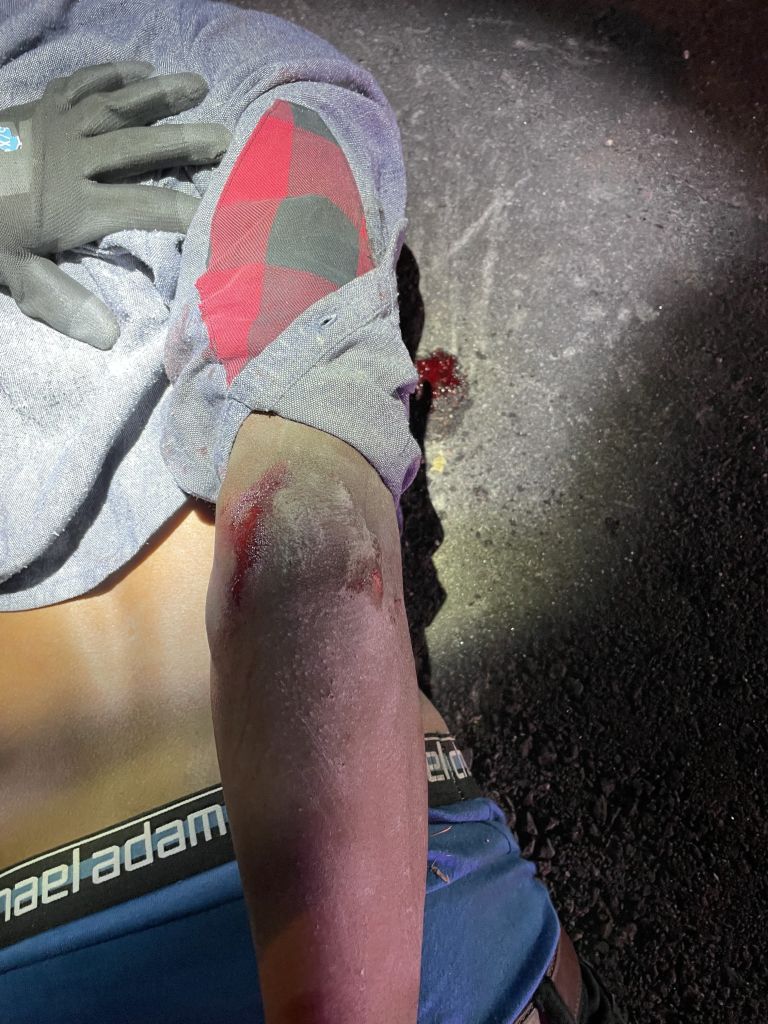 Dalvin Gadson, homeless Black veteran beaten by Colorado Springs police
