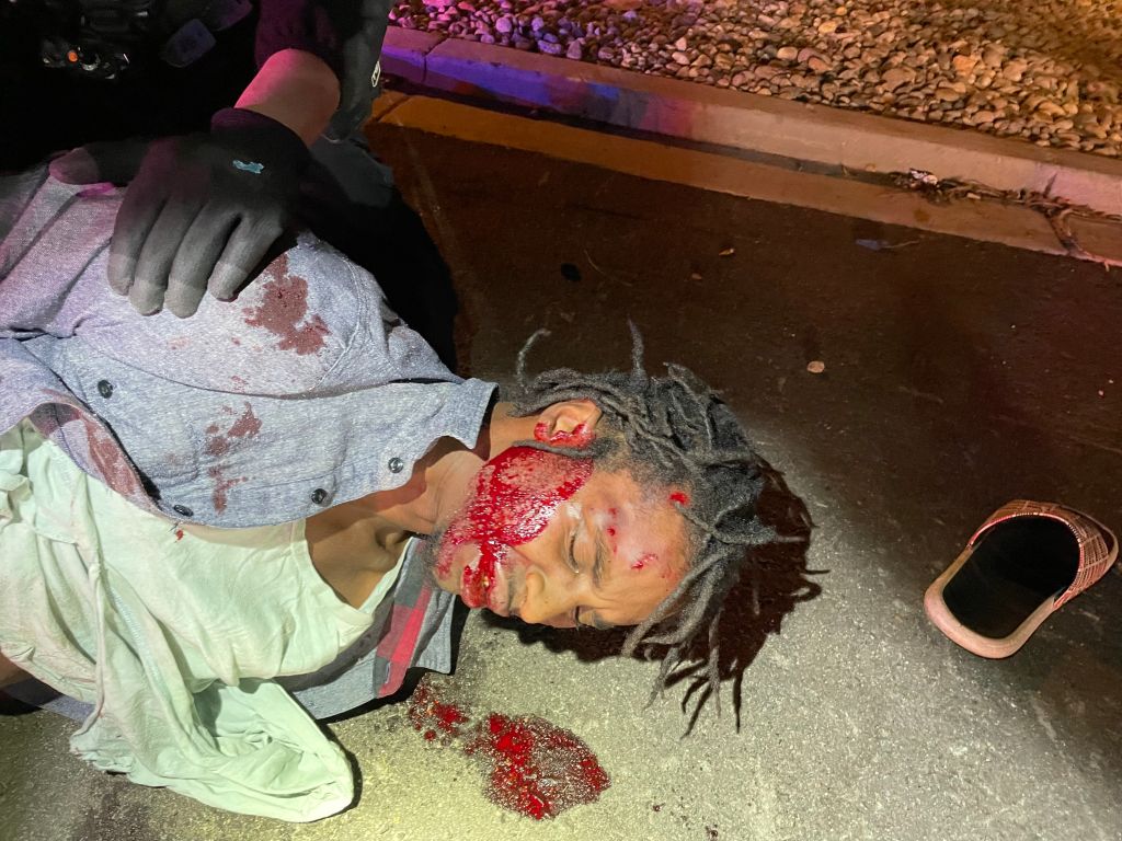 Dalvin Gadson, homeless Black veteran beaten by Colorado Springs police