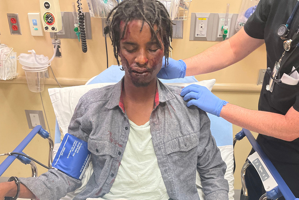 Dalvin Gadson, Colorado Springs police brutality victim