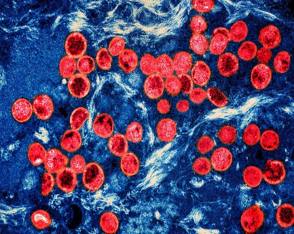 Monkeypox virus