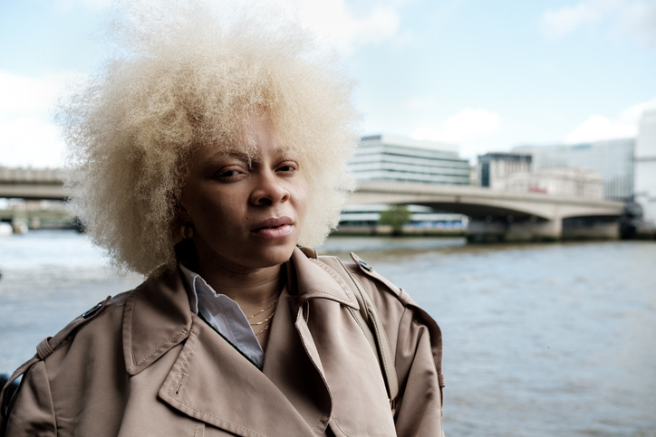 Black People With Albinism: Challenging Stereotypes